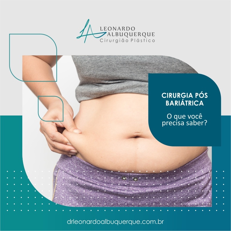 Cirurgia Pós Bariátrica: O que você precisa saber?