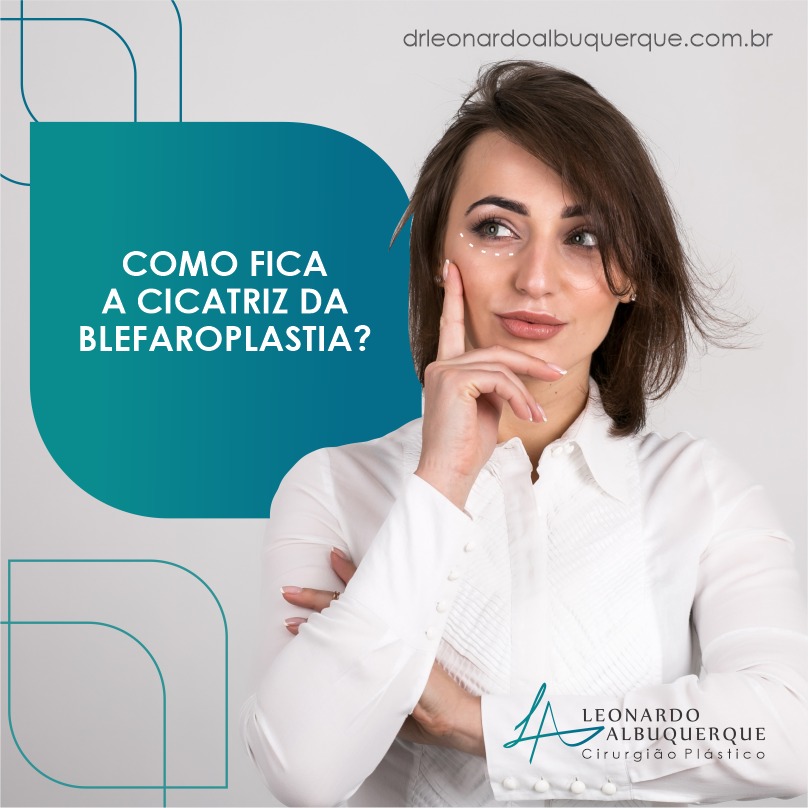 Como fica a cicatriz da Blefaroplastia?