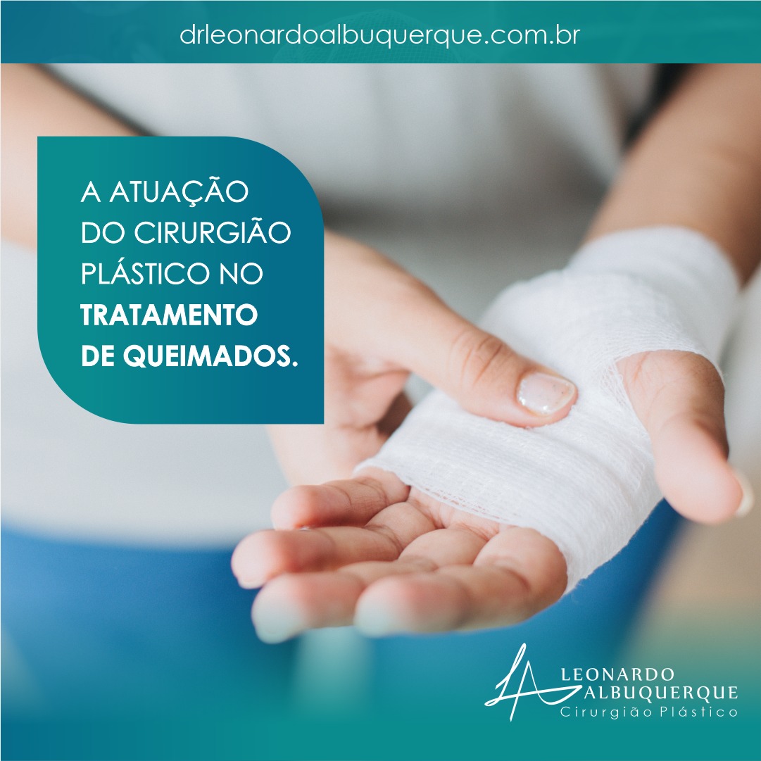 A atuação do cirurgião plástico no tratamento de queimados