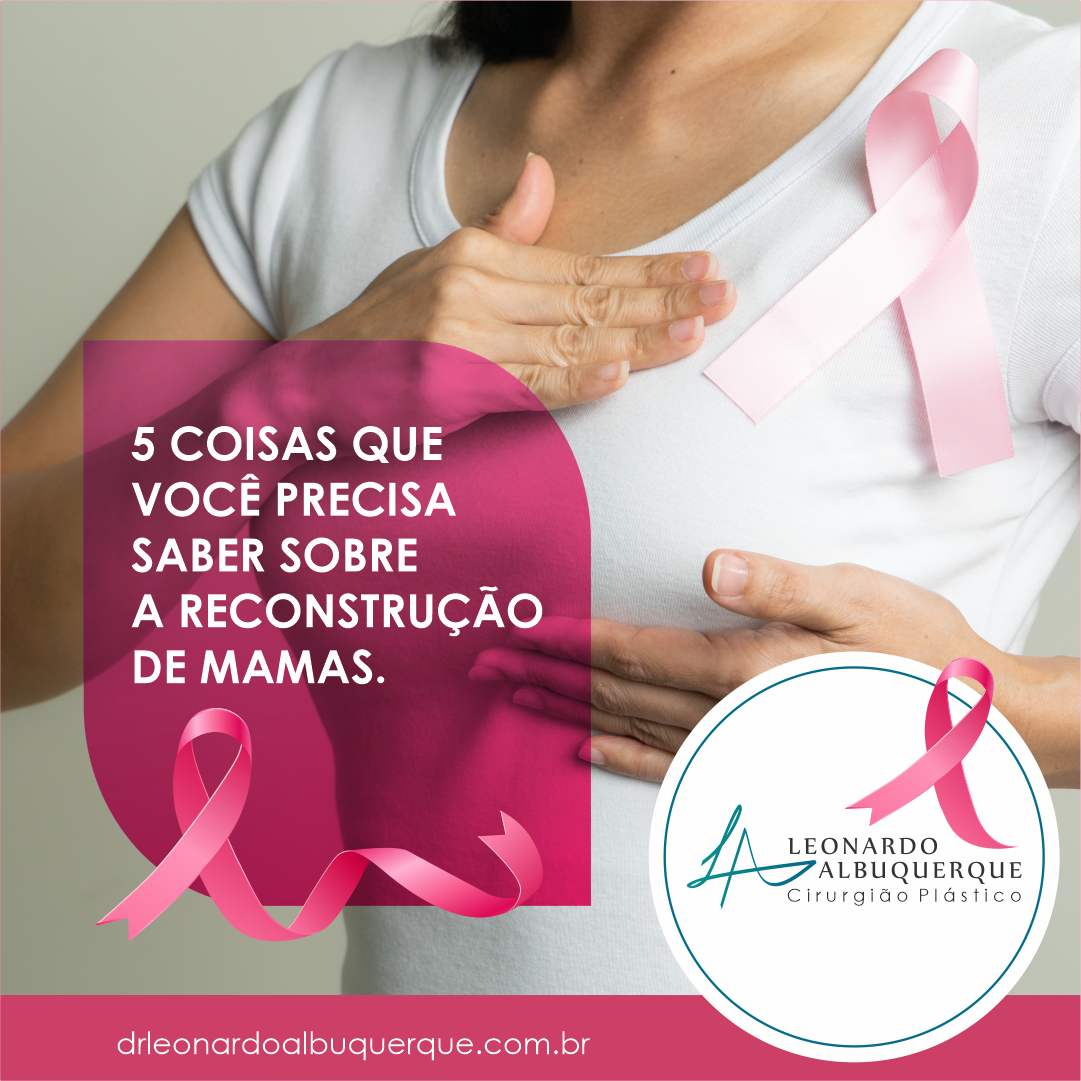 5 coisas que você precisa saber sobre a reconstrução mamária