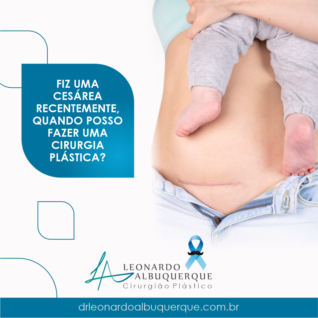 Fiz uma cesárea recentemente, quando posso fazer uma cirurgia plástica?